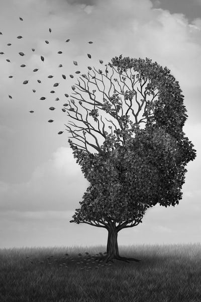 Qué hacer ante la enfermedad de Alzheimer