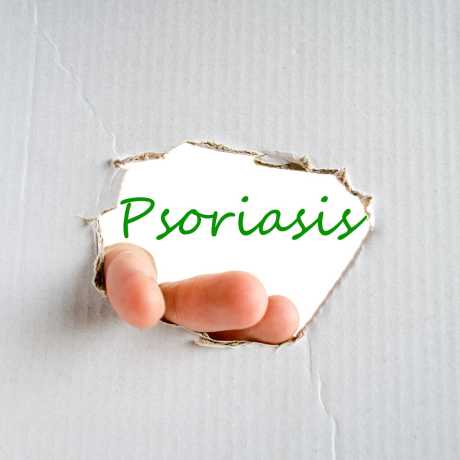 psoriasis que es tratamiento
