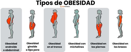 Tipos de obesidad: ¿dónde acumulas grasa? 2